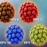 新加坡打HPV疫苗(子宫颈癌疫苗)的全面科普