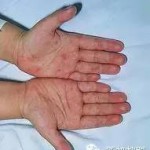 4月1日起,这些中药材在新加坡不再是“毒品”了