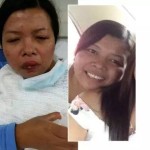 印尼女佣突患怪病,难道是被下了降头?