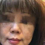 世上只有懒女人没有丑女人?我勤快又舍得花钱,但还是满脸斑!
