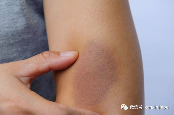 69岁老翁因不满被赶出家门，竟火爆殴打61岁同居女友