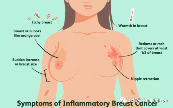 180份乳腺癌報告全錯,新加坡醫院5名職員遭到處分