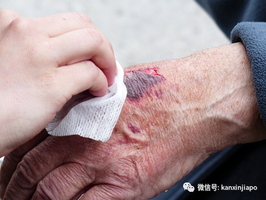 93歲老翁暴打85歲室友,只因睡覺時該不該關燈