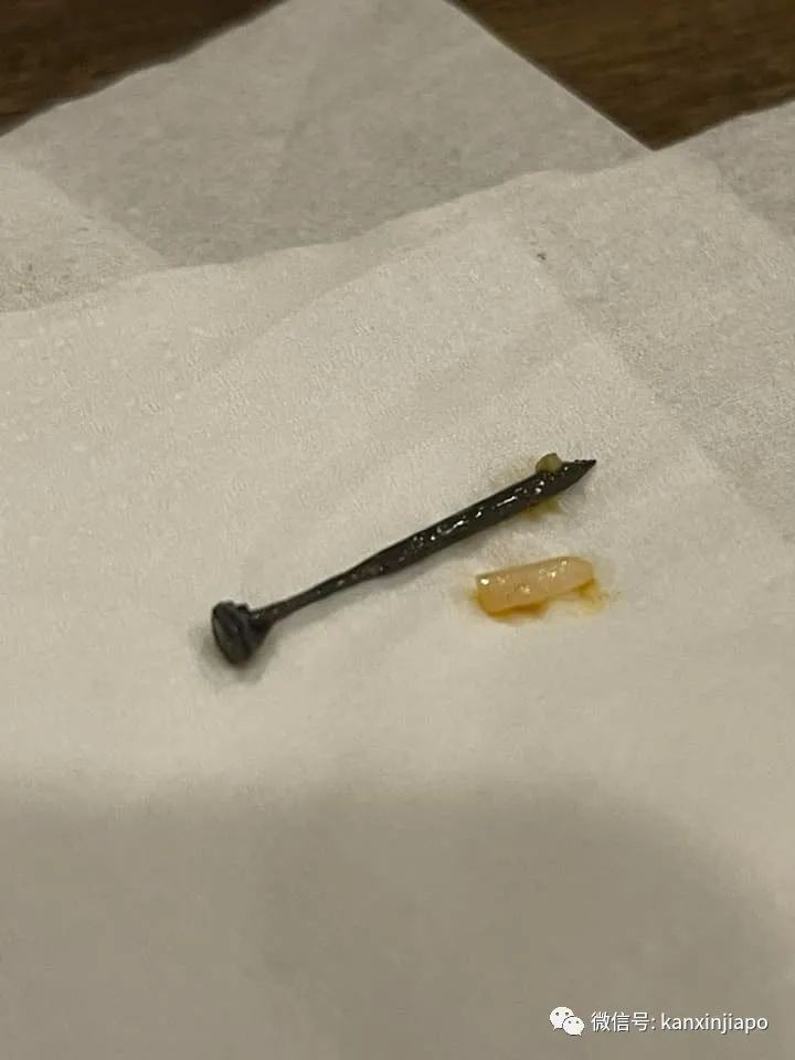 吃椰漿飯竟咬到鐵釘!新加坡女子差點“死亡”,咬崩牙還腹瀉