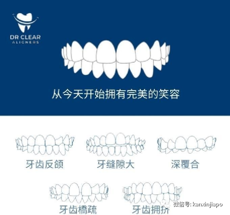 在新加坡你绝不能错过的牙齿矫正方案！