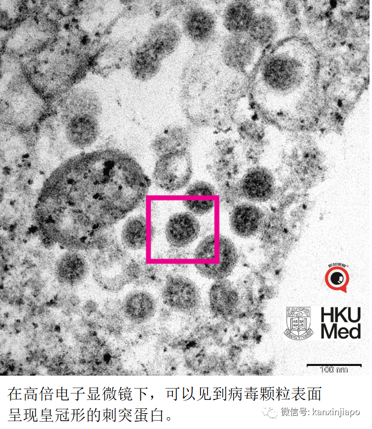 今增 709 | 最新！奥密克戎毒株又变异了？竟能躲过核酸检测！
