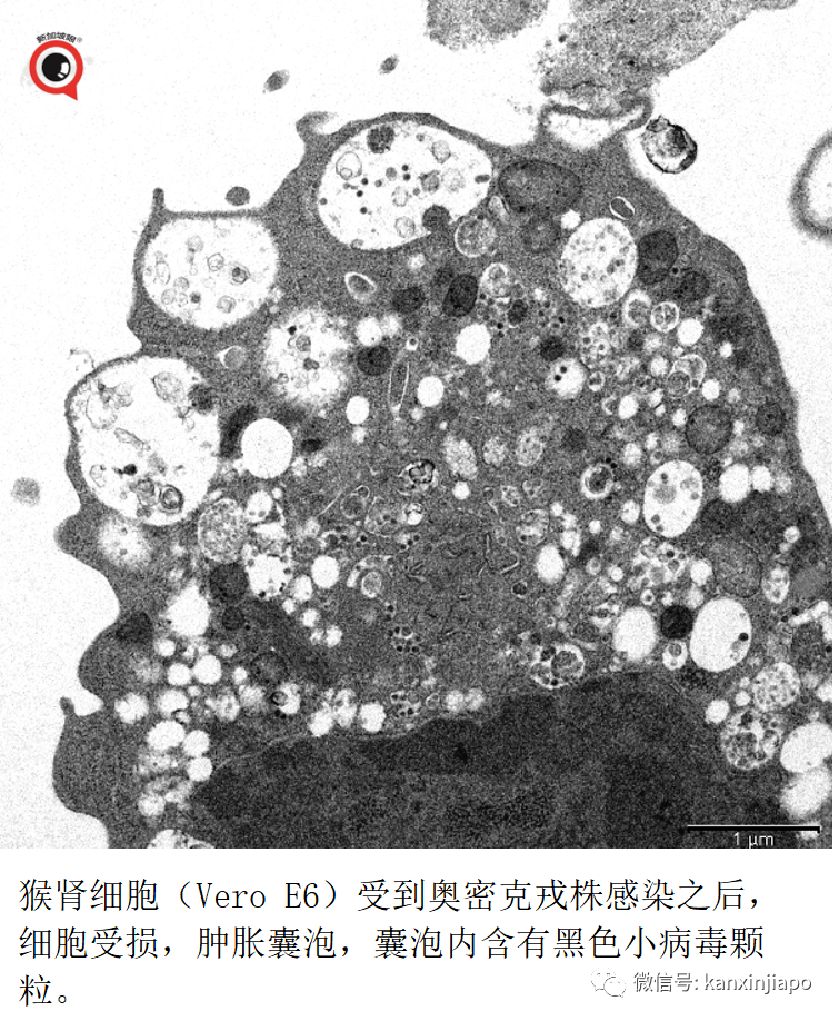 今增 709 | 最新！奥密克戎毒株又变异了？竟能躲过核酸检测！