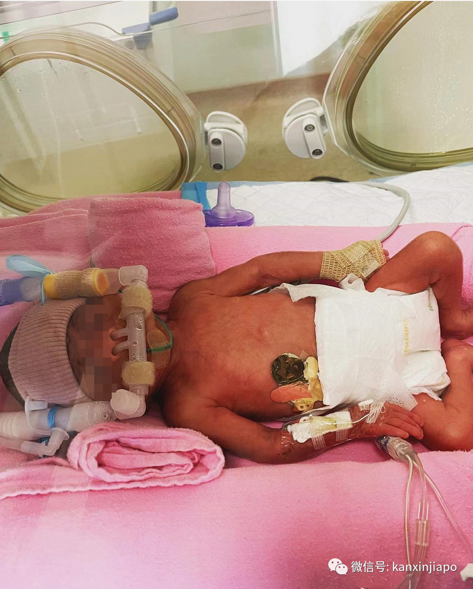 這個生下來只有1030克的極度早産兒,活下去還需要幾十萬新幣...