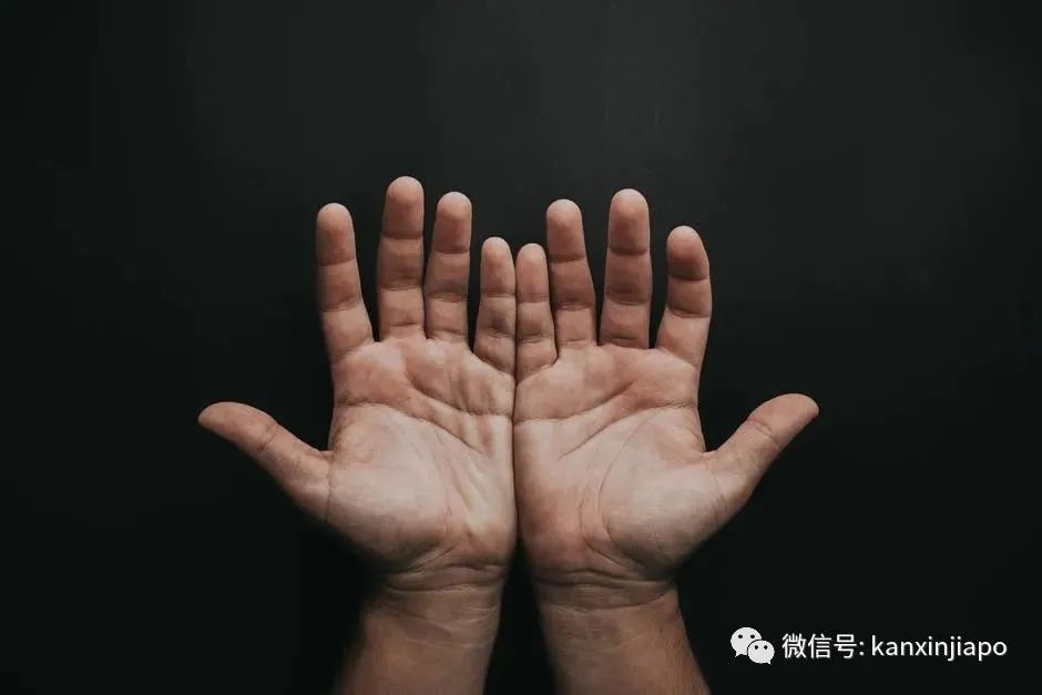 Nature子刊:看手指长度可预测患新冠严重程度