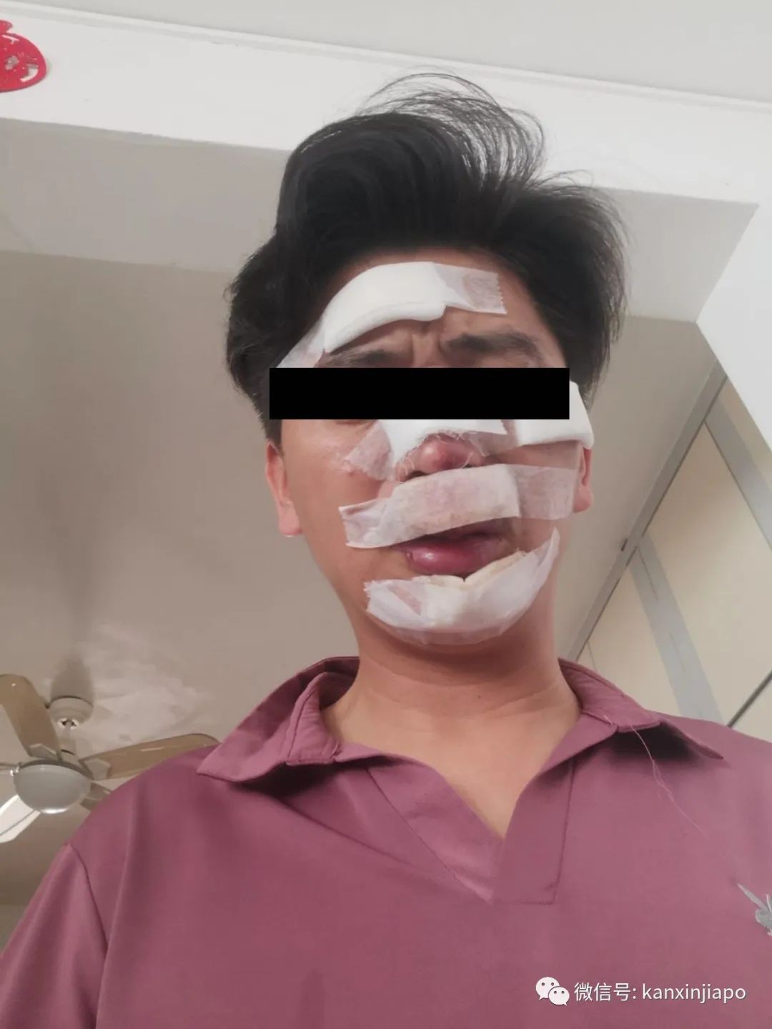 7岁新加坡男孩在新山险遭熟人绑架，父亲为救儿摔断两颗牙