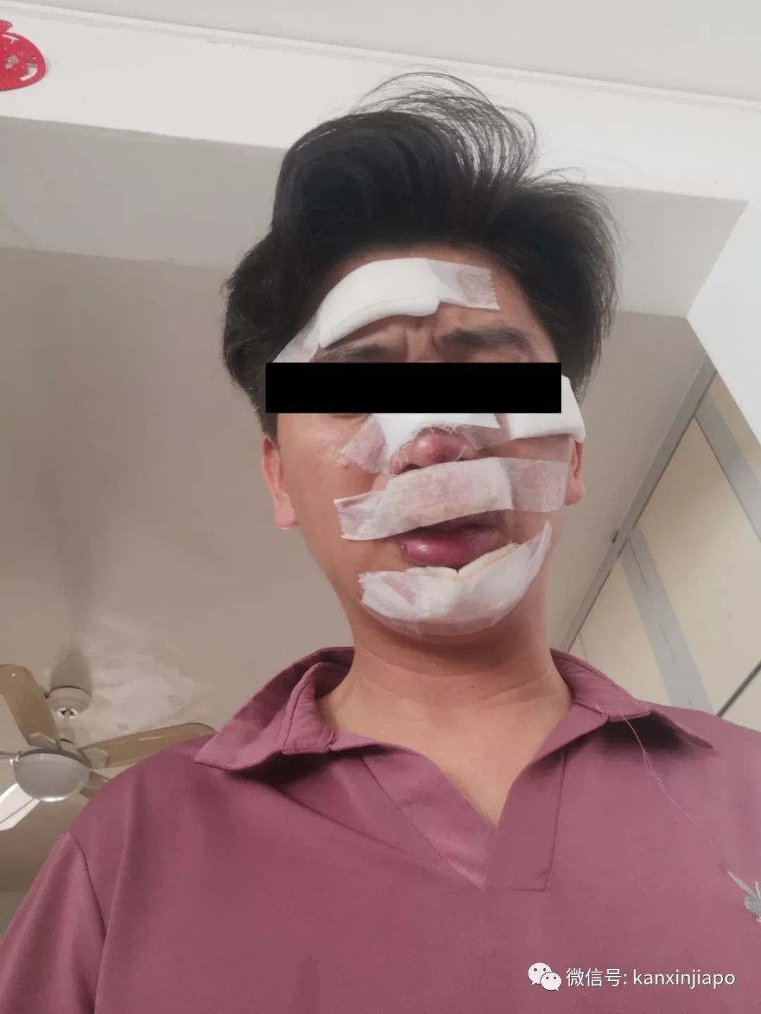 7岁新加坡男孩在新山险遭熟人绑架,父亲为救儿摔断两颗牙