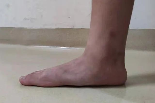 步步无忧:揭秘脚底板疼痛之谜及瞬间缓解妙招!