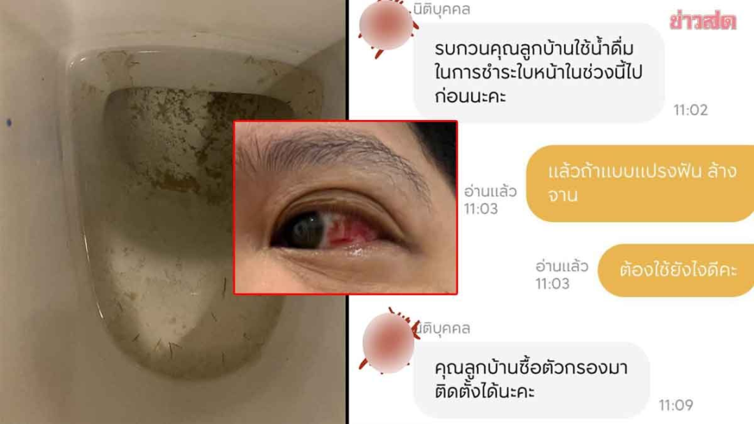 200人感染险失明！寄生虫侵袭泰国曼谷