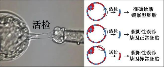 第三代试管婴儿治疗,新加坡不孕不育夫妻的一场昂贵、冒险和不必要的赌博?