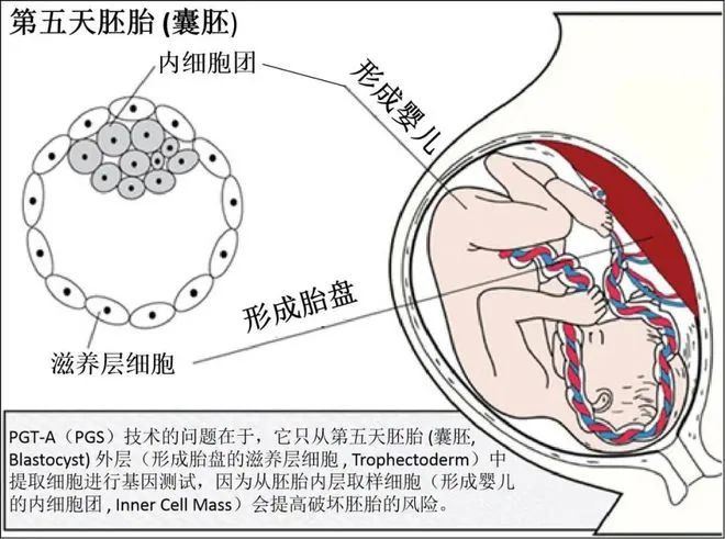 第三代试管婴儿治疗,新加坡不孕不育夫妻的一场昂贵、冒险和不必要的赌博?