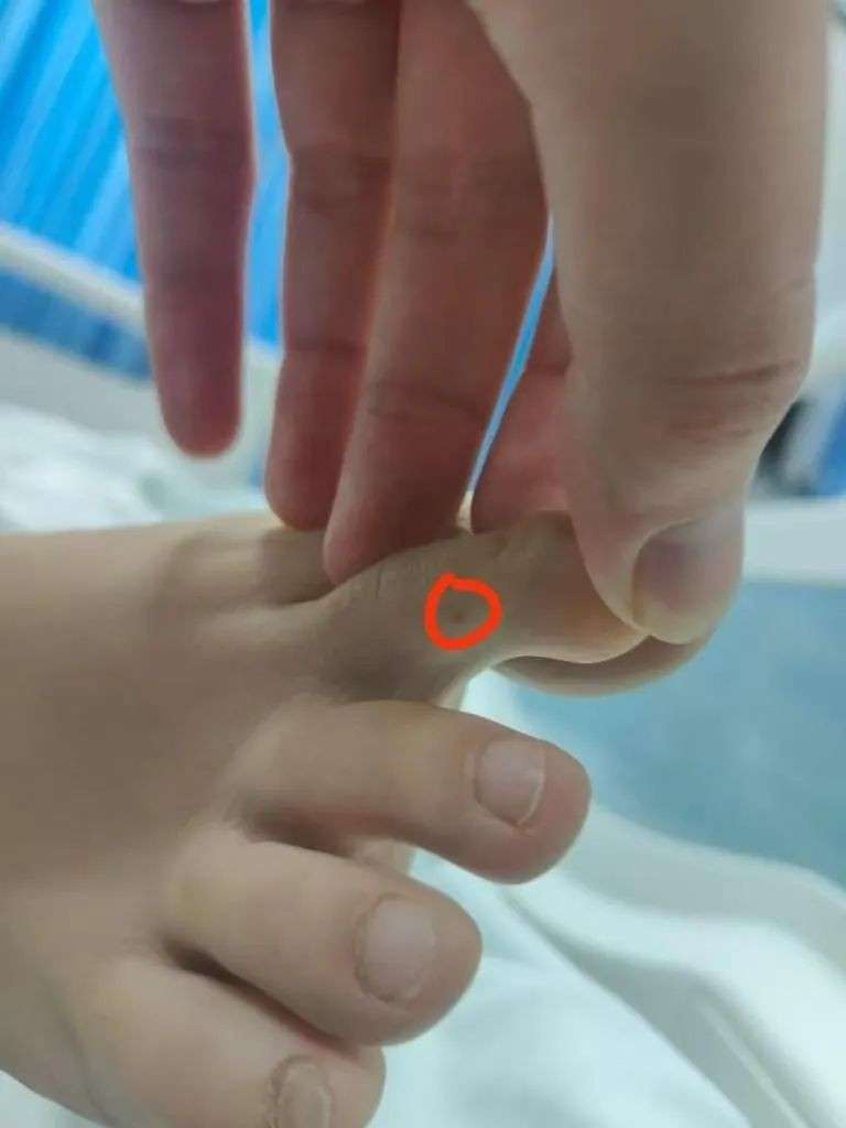 新加坡女幼师三亚旅游疑遭蛇咬身亡，亲属直播回应网友疑问，最新细节曝光
