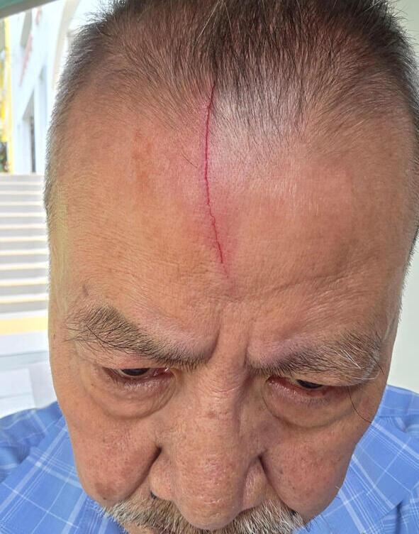 新加坡组屋区发生乌鸦连环袭人事件!疑鸟窝被拆,开启疯狂报复模式
