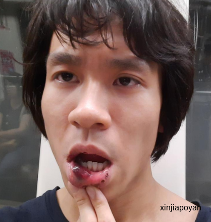 新加坡争议网红硬闯动漫展,被cos小哥当场暴打